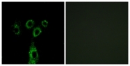 C15957-1 - GPRASP1