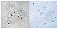 C16573-1 - MED13L