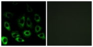 C16618-1 - MBTPS2