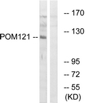 C17074-1 - POM121