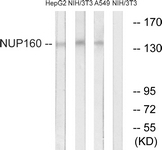 C17093-1 - NUP160