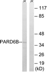 C17606-1 - PARD6B