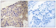 C17648-1 - Peroxin 10 / PEX10 / RNF69