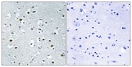 C17657-1 - PPRC1
