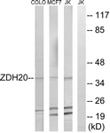 C17951-1 - ZDHHC20