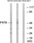 C17991-1 - FNTB