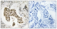 C18035-1 - PMS2/PMS2CL