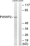 C18097-1 - PWWP2B