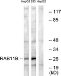 C18218-1 - RAB11B
