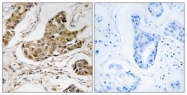 C18443-1 - RTCD1