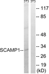 C18492-1 - SCAMP1