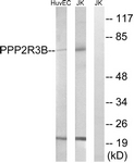 C18645-1 - PPP2R5D