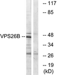 C19486-1 - VPS26B