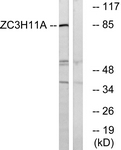 C19574-1 - ZC3H11A