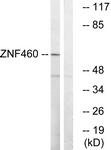 C19600-1 - ZNF272