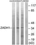 C19633-1 - ZADH1