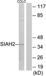 C19672-1 - SIAH2