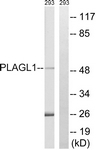 C20728-1 - PLAGL1