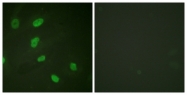 D0003-1 - Histone H2B