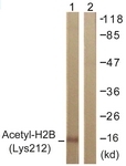 D0004-1 - Histone H2B
