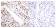 D0004-1 - Histone H2B