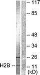 D0005-1 - Histone H2B