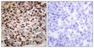 D0005-1 - Histone H2B