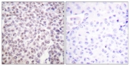 D0023-1 - Histone H2B