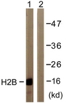 D0024-1 - Histone H2B
