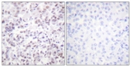 D0024-1 - Histone H2B