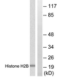 D0025-1 - Histone H2B