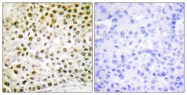 D0025-1 - Histone H2B