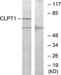 G070-1 - CLPTM1
