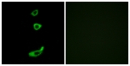 G072-1 - CRHR1