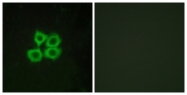 G073-1 - CRHR2