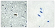 G213-1 - BAI1