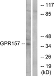 G306-1 - GPR157