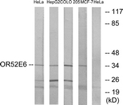G462-1 - Olfactory receptor 52E6