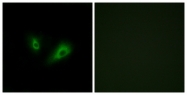 G498-1 - Olfactory receptor 10D4