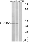 G539-1 - Olfactory receptor 2B2