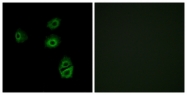 G539-1 - Olfactory receptor 2B2