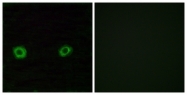 G546-1 - Olfactory receptor 2D3