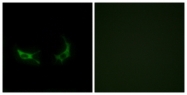 G561-1 - Olfactory receptor 2M3