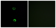 G577-1 - Olfactory receptor 3A2
