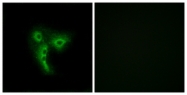 G581-1 - Olfactory receptor 4A4/4A47
