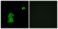 G585-1 - Olfactory receptor 4C6