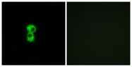 G885-1 - Olfactory receptor 1D4/1D5