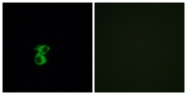 G917-1 - Olfactory receptor 6B2