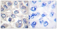 L0102-1 - Bcl-2-like 8