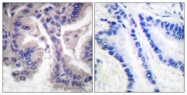 L0107-1 - Caspase-6